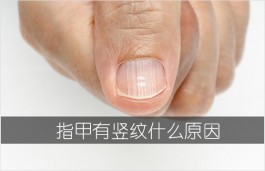 指甲有竖纹什么原因（指甲有竖纹是身体的什么信号）